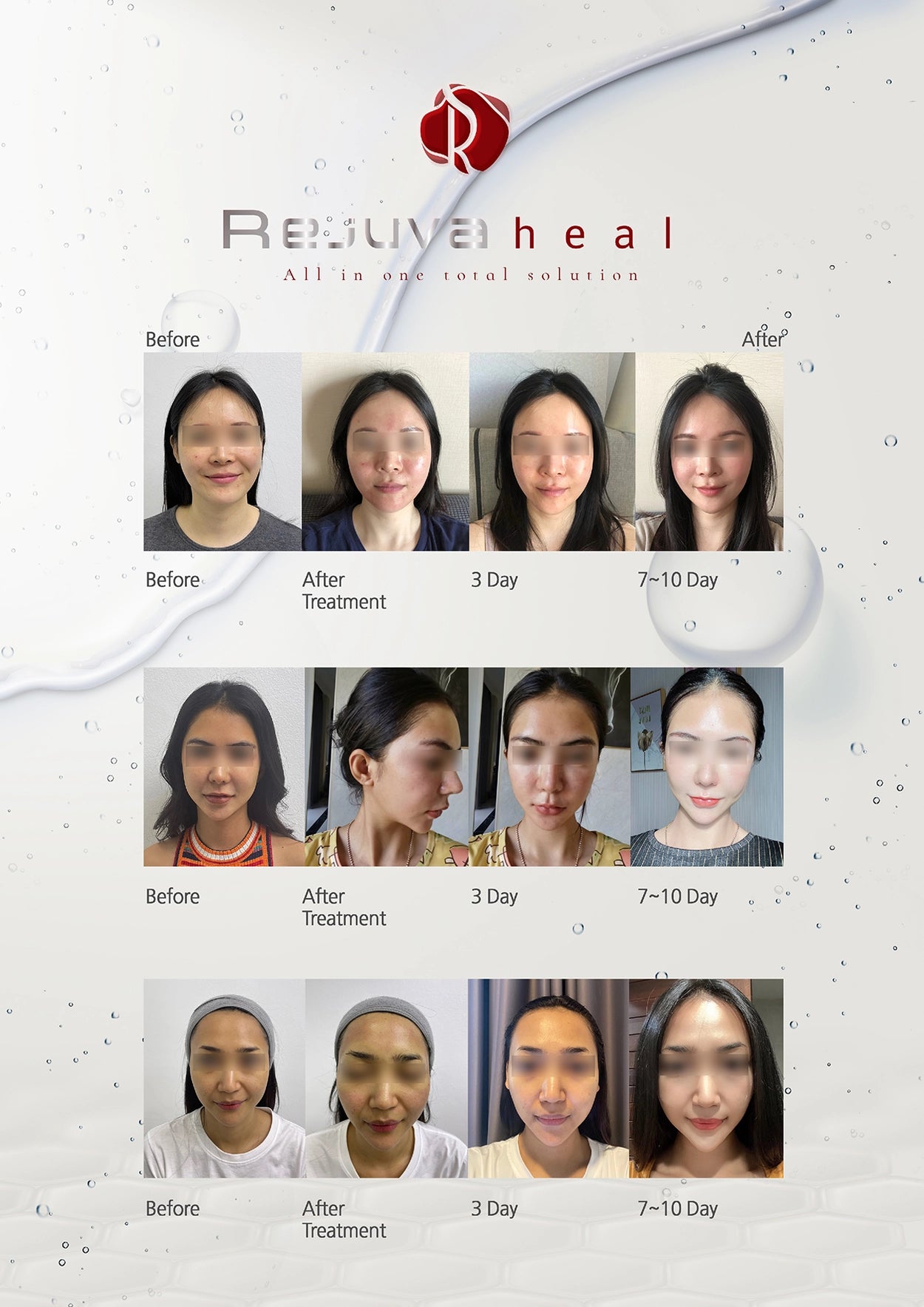 Rejuva Heal - XQ