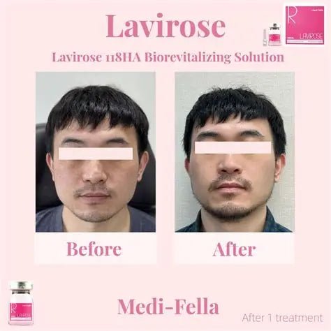 Lavirose 118HA Bio Revitalizing Solution - XQ