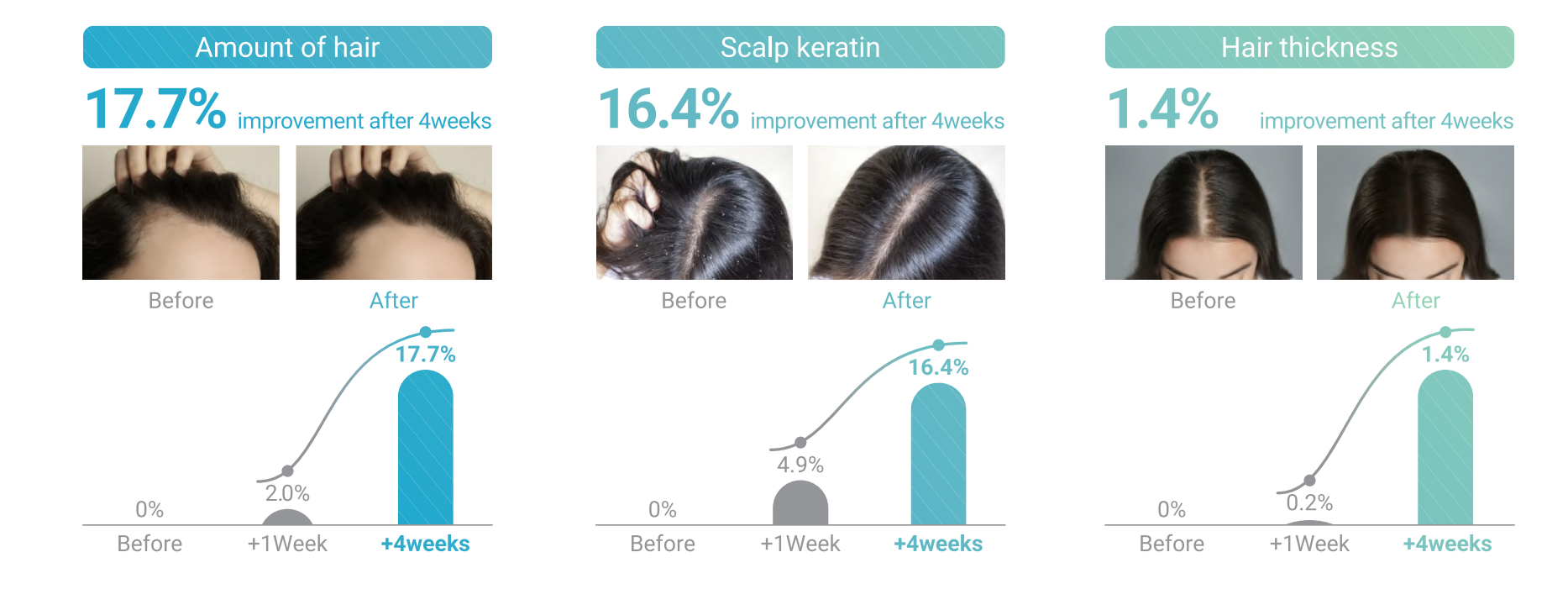 Velash EXO PLUS Hair Scalp Treatment - XQ