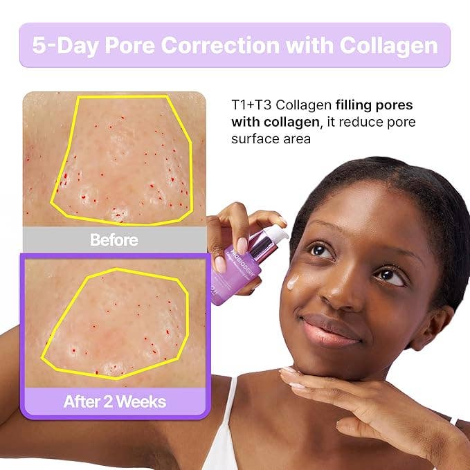 BIOHEAL BOH Probioderm™ Collagen Remodeling Serum 1.01 fl oz (30 ml) - XQ