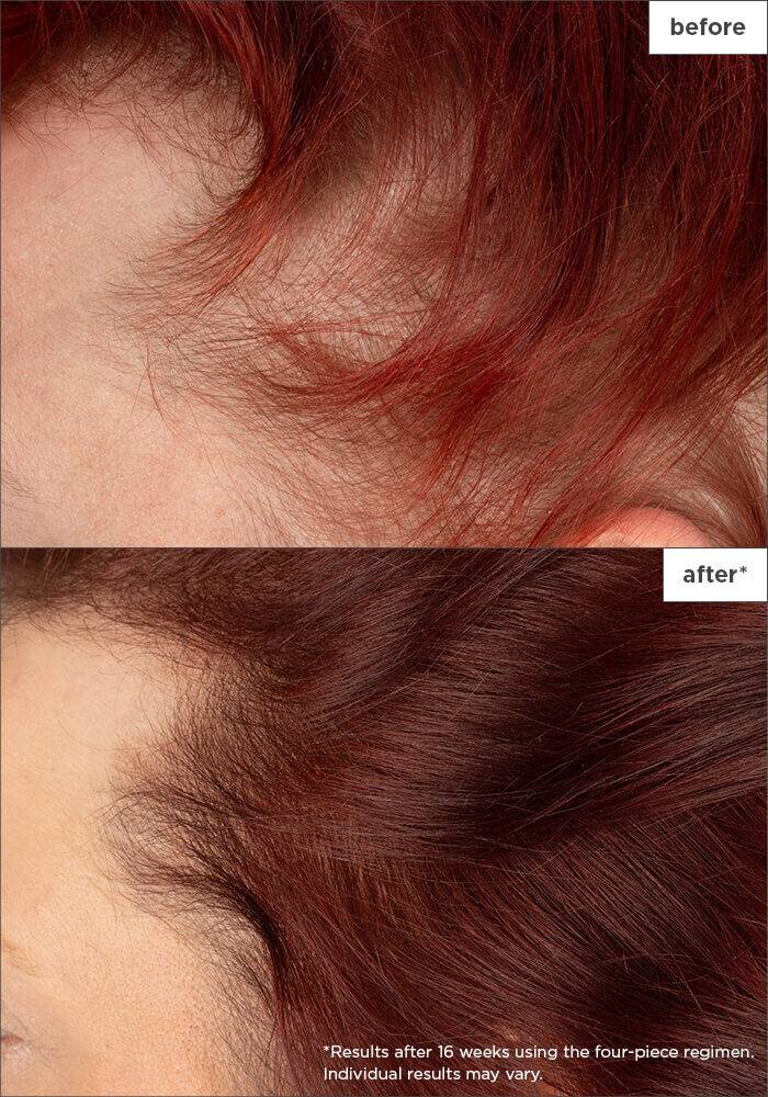 Briogeo Destined For Density™ MegaStrength+ Density Serum 1.5oz - XQ