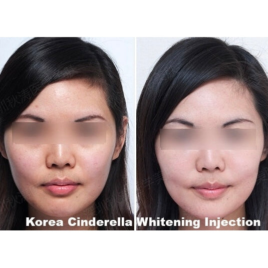 Cindella Skin Anti-Aging Boost Whitening Set - XQ
