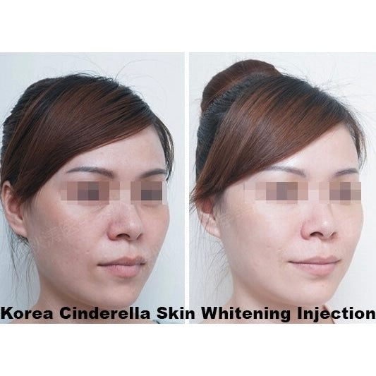 Cindella Skin Anti-Aging Boost Whitening Set - XQ