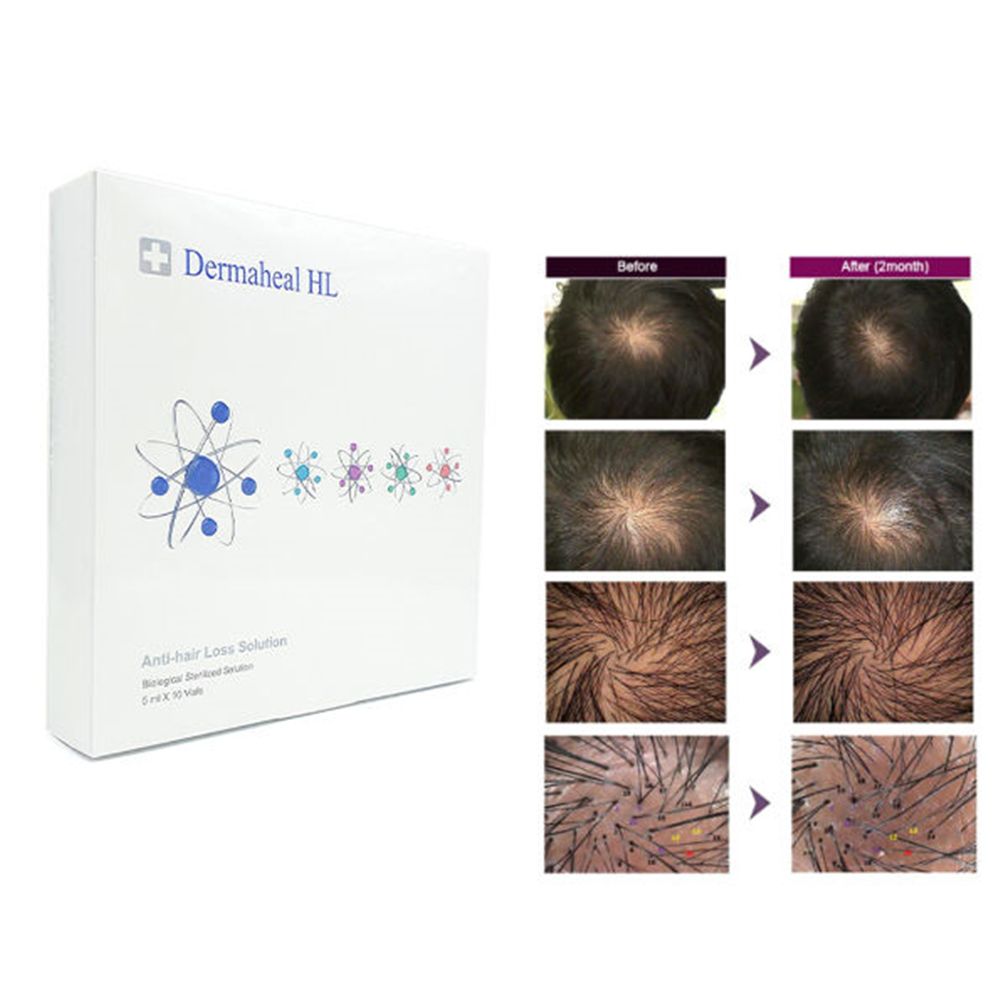 DermaHeal HL Hair Growth Solution - XQ