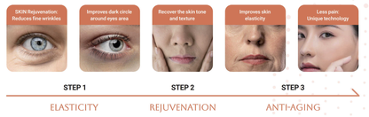 Eyebella - PN Skin Booster - XQ