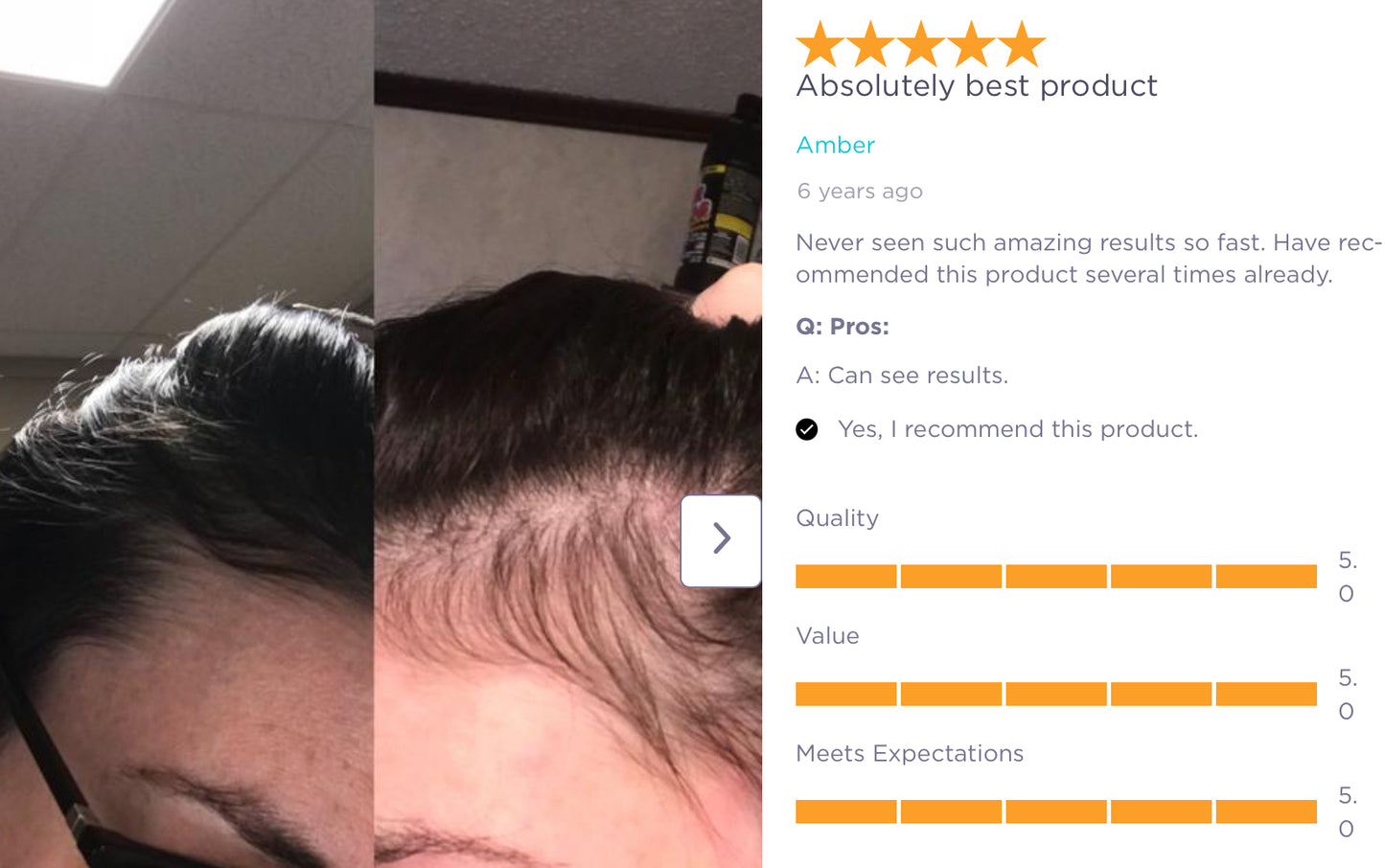 Viviscal Professional -  Hair Growth Supplement - XQ