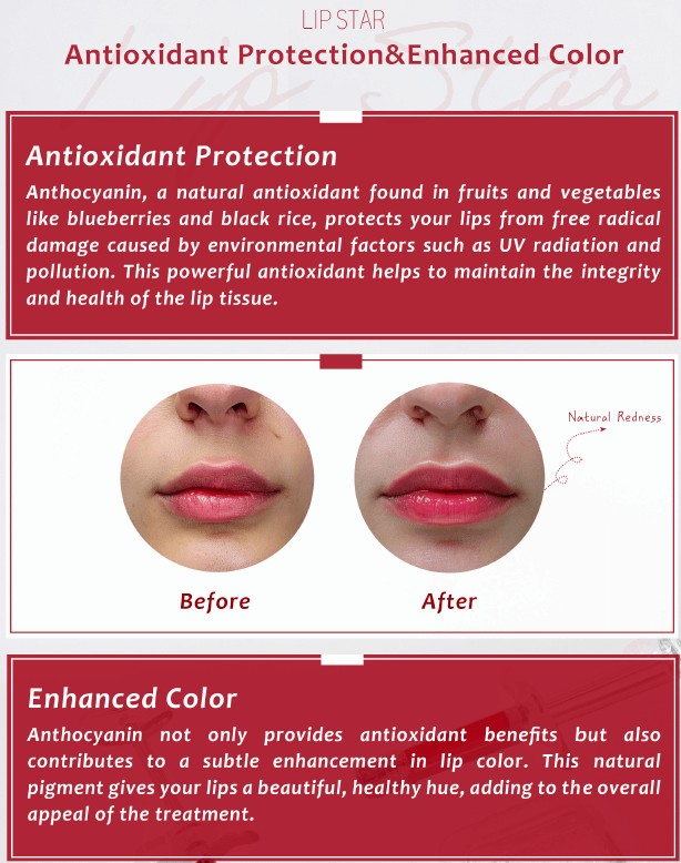 LipStar - Lip Star - XQ