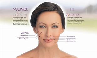 Juvederm Volux (2 x 1mI) - XQ