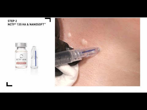 Fillmed - NCTF 135 HA 