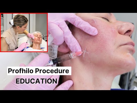 Profhilo H+L 2 ml 