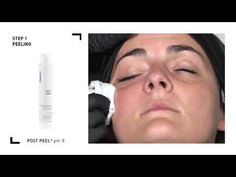 Fillmed - NCTF 135 HA 