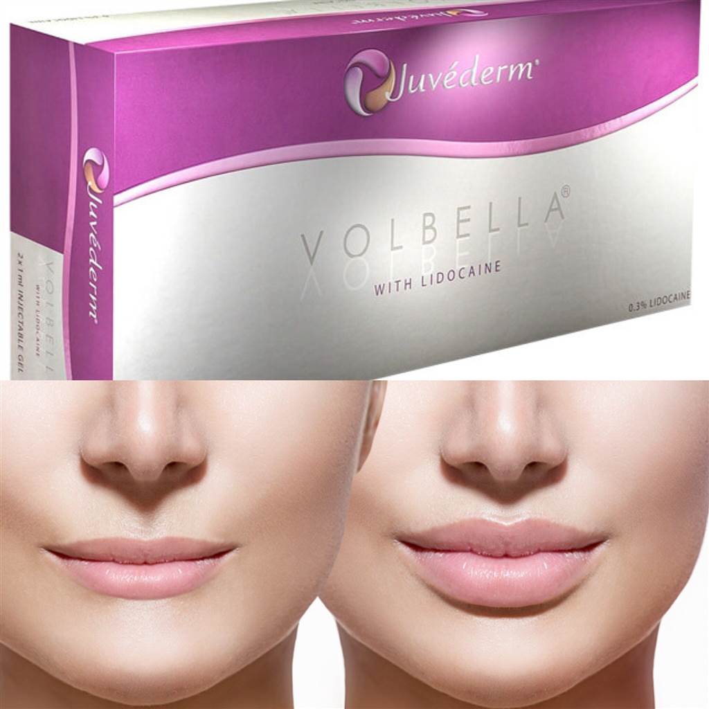 Juvéderm Volbella (2 x 1mI) - XQ